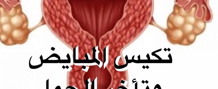 علاج التكيس - تكيس المبايض علاجه الحرص والاهتمام 5378 1