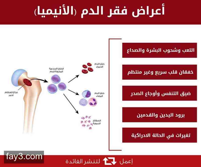 اعراض فقر الدم - فقر الدم واعراضه 1410 2