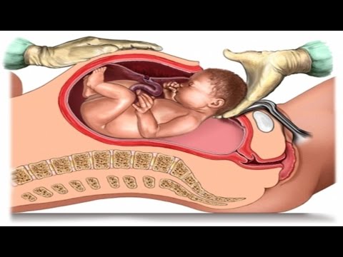 اشياء تسهل الولاده - عادات تجعلك تلدين بسهوله 155 2