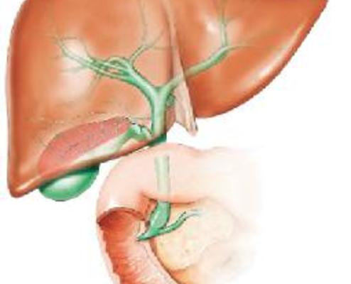 علاج تليف الكبد - تليف الكبد انتشر بسبب الجهل 5513