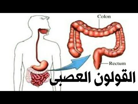 القولون العصبي - اسبابه اعراضه و علاجه 5719 2