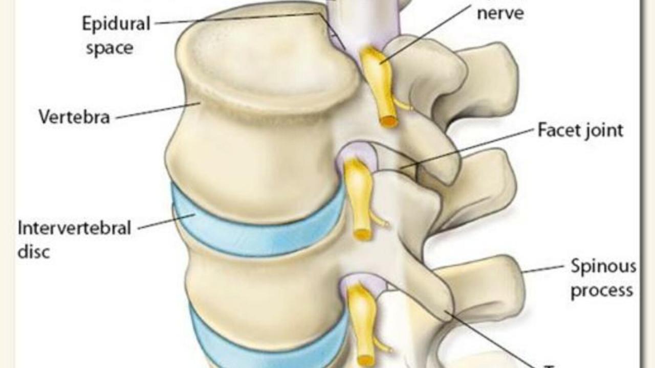 علاج ديسك الظهر - ما هو القرص او ديسك الظهر 12136 1