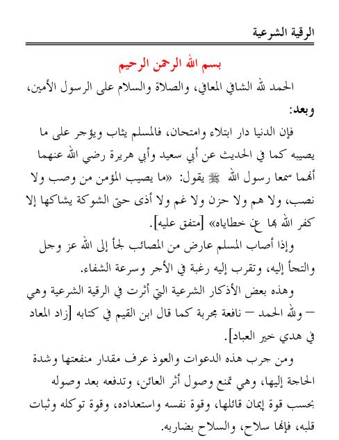 الرقية الشرعية لعلاج السحر- احسن طريقه للتخلص من السحر 11304 3