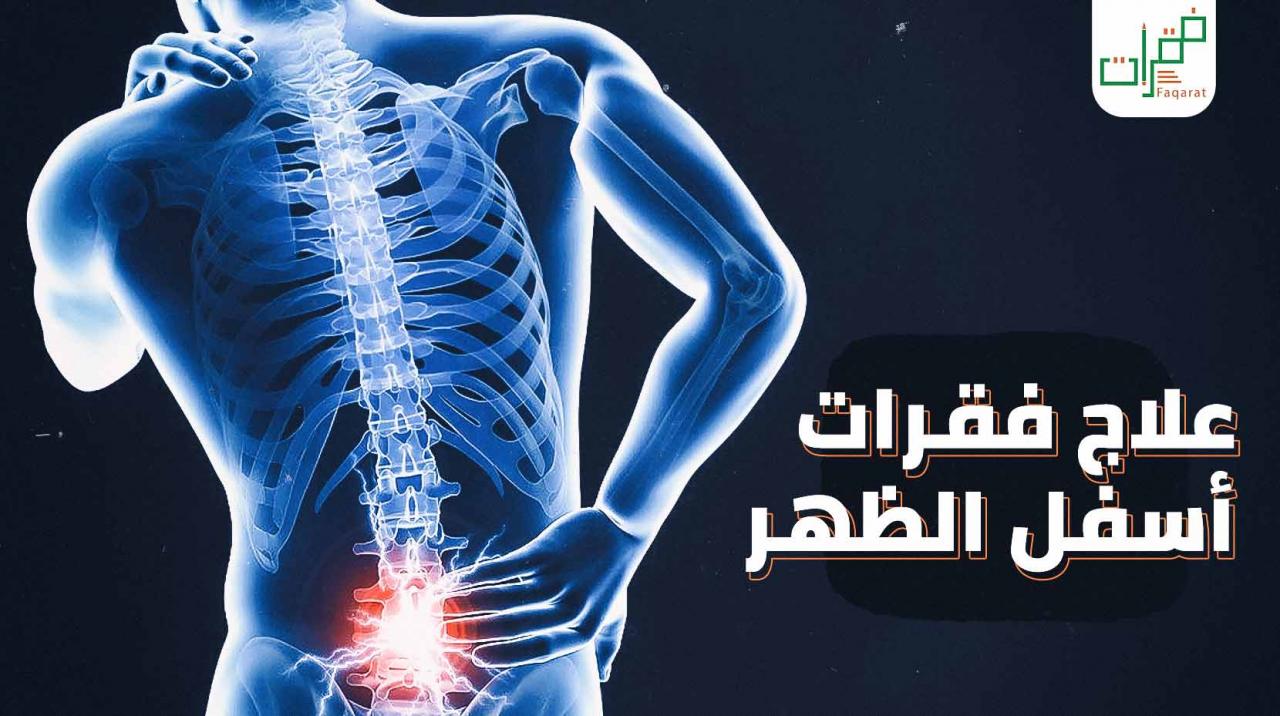 علاج فقرات الظهر 11735 2