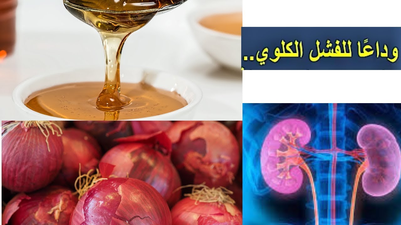 علاج قصور الكلى - طرق علاجها&Nbsp;