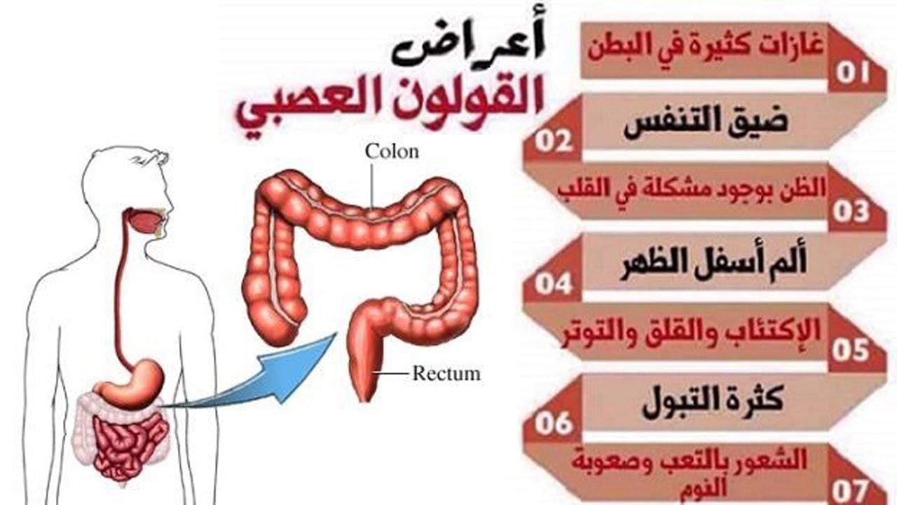 اعراض القولون المتهيج