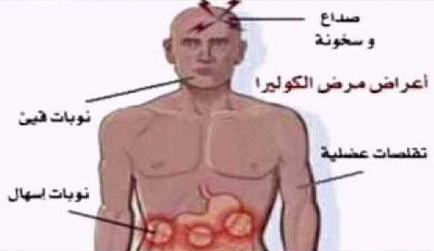 اعراض مرض الكوليرا - امراض بكتيريه معديه 2189 1