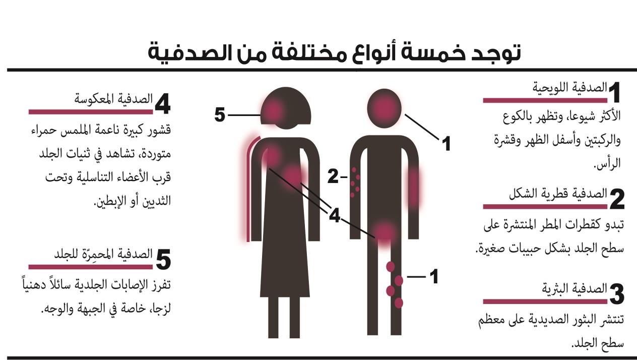 اعراض الصدفية , تعرف على مرض الصدفية واعراضه