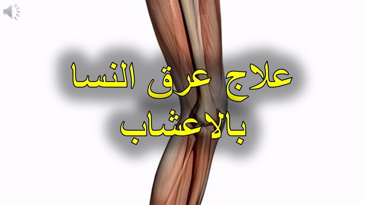 علاج عرق النسا بالاعشاب 4957 1