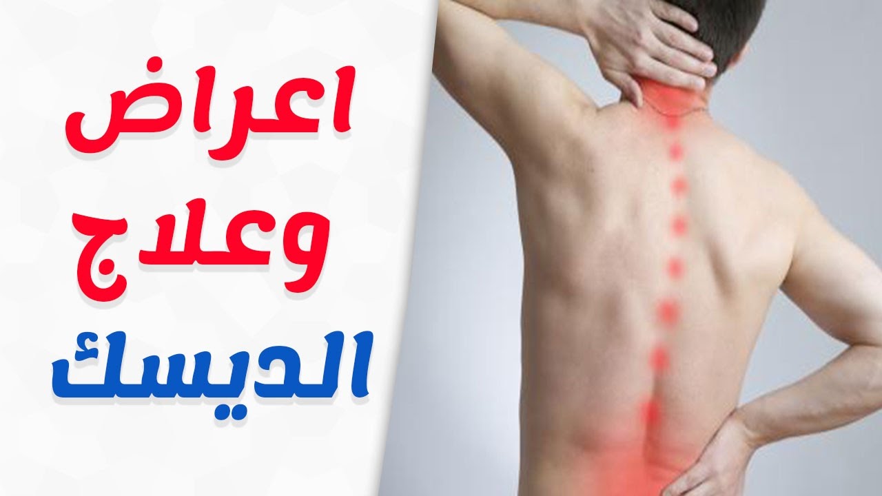 علاج فقرات الظهر 11735 1