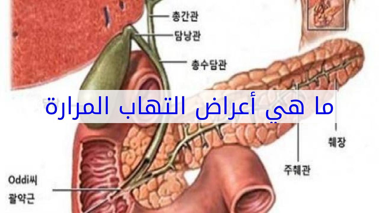 اعراض المرارة - الامراض المزمنه و اعراضها 2530 2