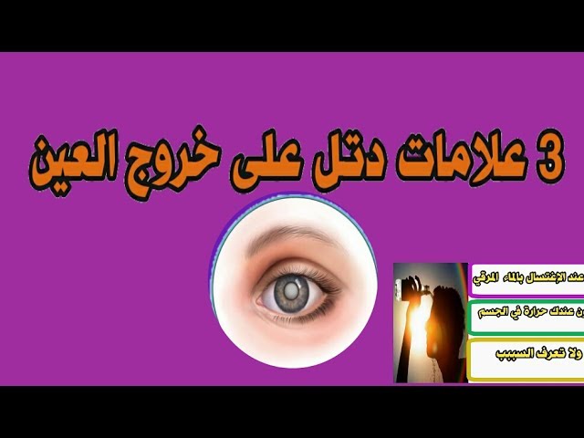 علامات خروج الحسد- ازاي تعرفي ان الحسد خرج 11120 2