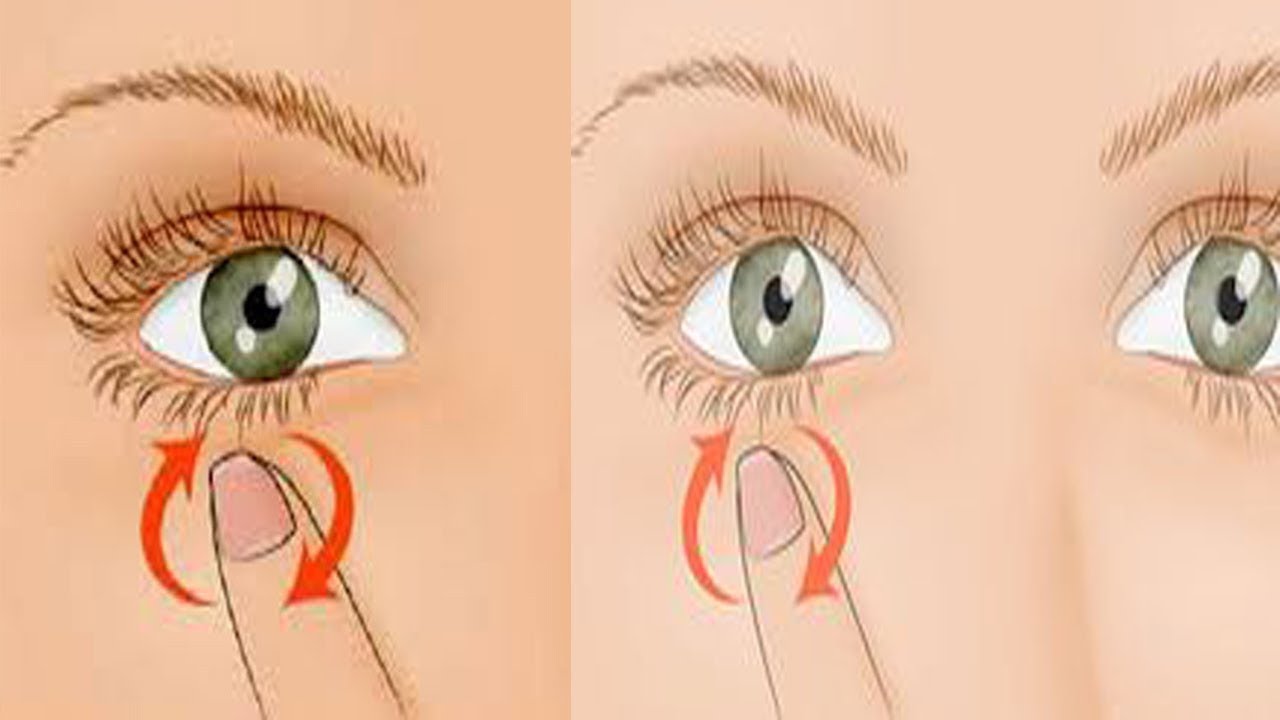 اسباب رعشة جفن العين اليسرى 11875 1