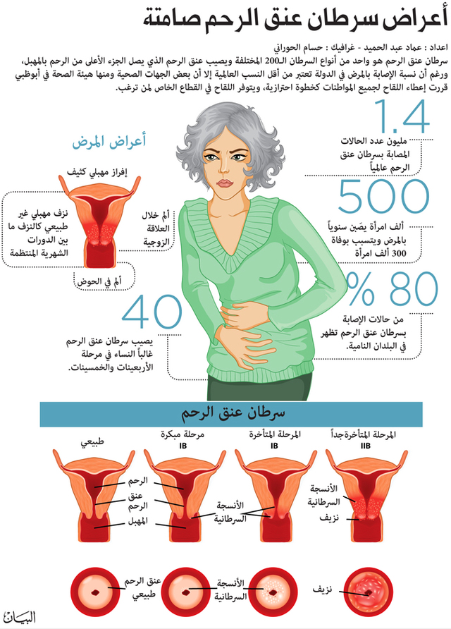 اعراض سرطان الرحم - سرطان الرحم اسبابه وعلاجه 1541 1