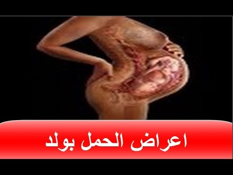 علامات الحمل بولد في الشهر الثاني - تعرف علي علامات الحمل بولد منذ الشهور الاولي 6320