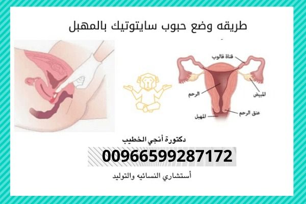 طريقة استخدام حبوب سايتوتك للاجهاض , حبوب تستخدم بشكل اساسي