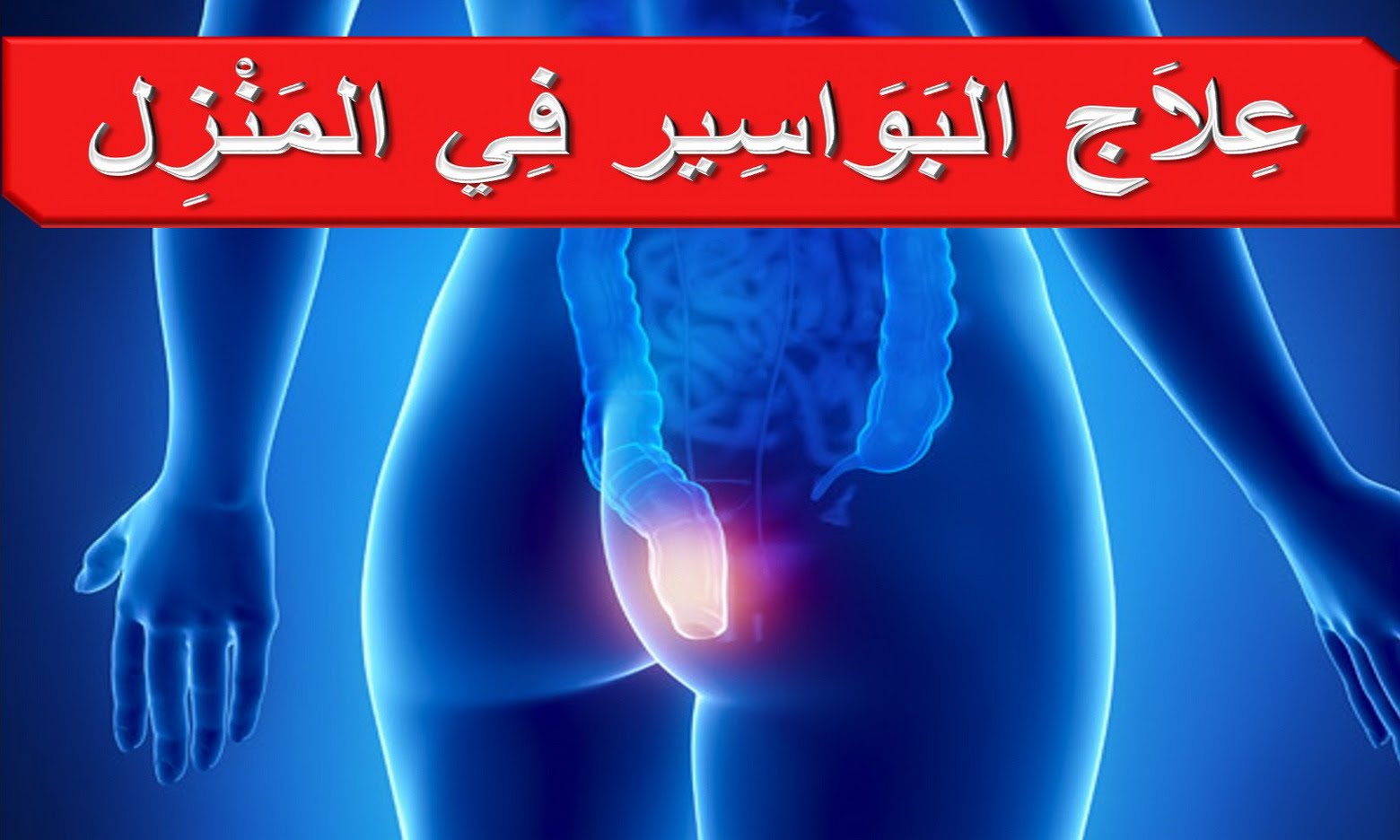 مرض البواسير اعراضه وعلاجه المنام