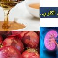 12125 3 علاج قصور الكلى - طرق علاجها  منال مصطفى