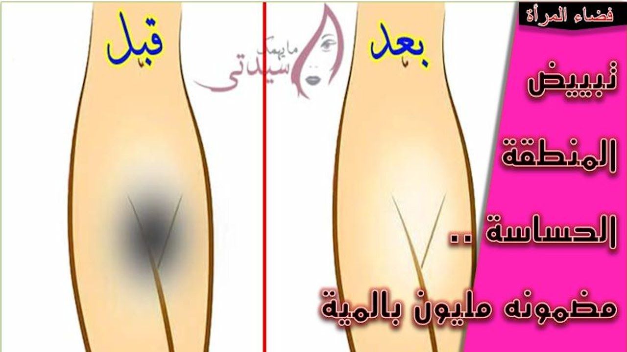 طرق تبييض المناطق الحساسة