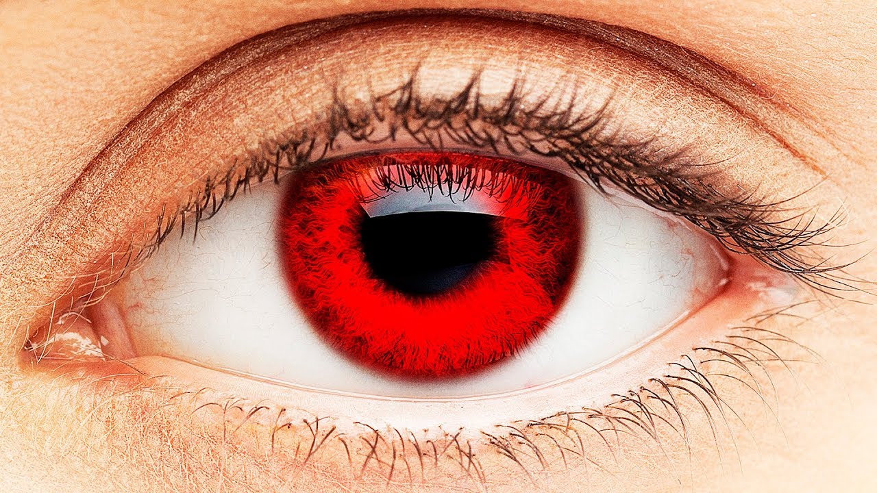 4132 العين الحمراء-عايز تعرف ليه عيناك يوجد بها حمره شاهر